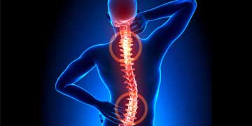 Best Spine Surgery Hospital in PCMC